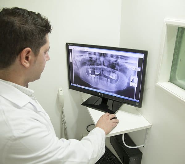 How much does a dental xray cost