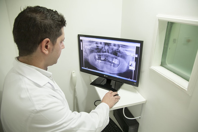 How much does a dental xray cost