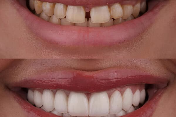 cosmetic dentist near me
