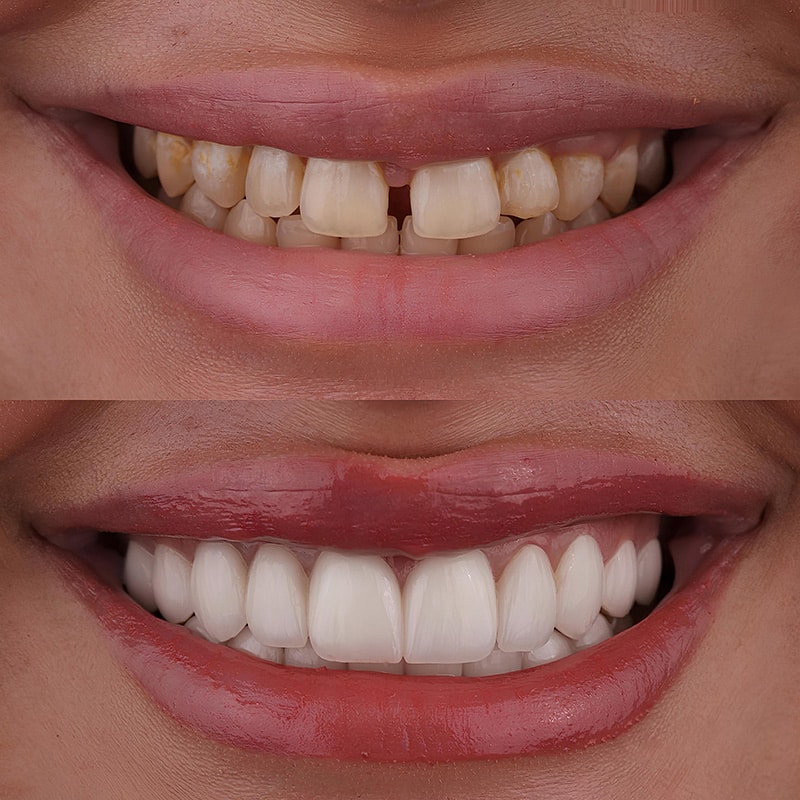 cosmetic dentist near me